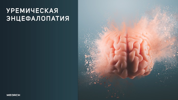 Уремическая энцефалопатия