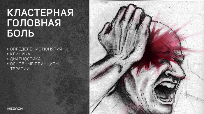 Кластерная головная боль