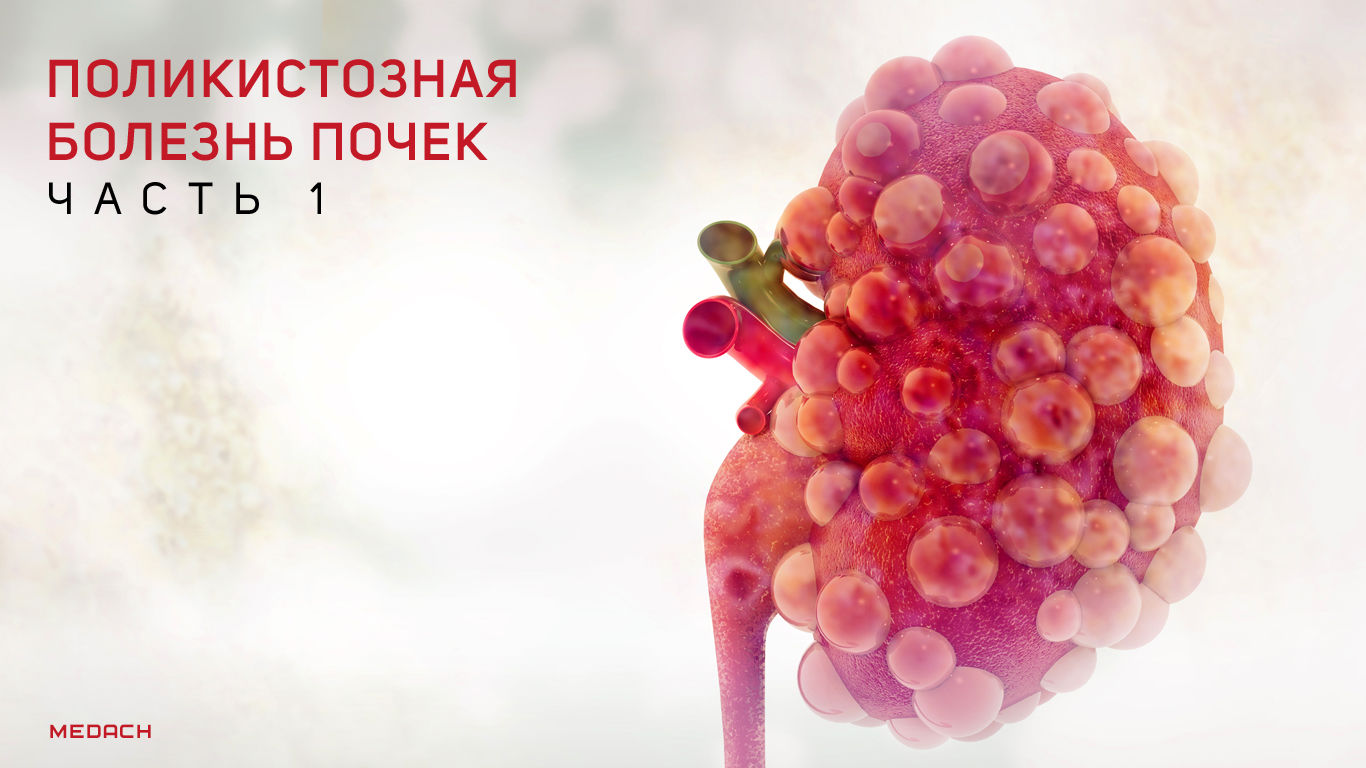 Поликистозная болезнь почек с аутосомно-рецессивным типом наследования