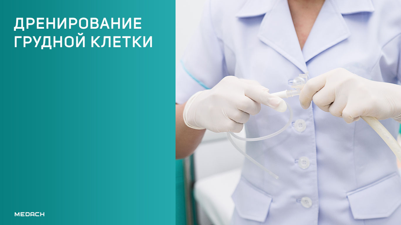 Дренирование грудной клетки
