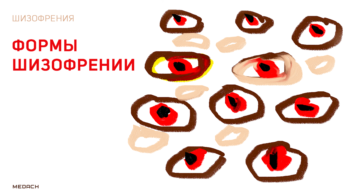 Шизофрения. Формы шизофрении