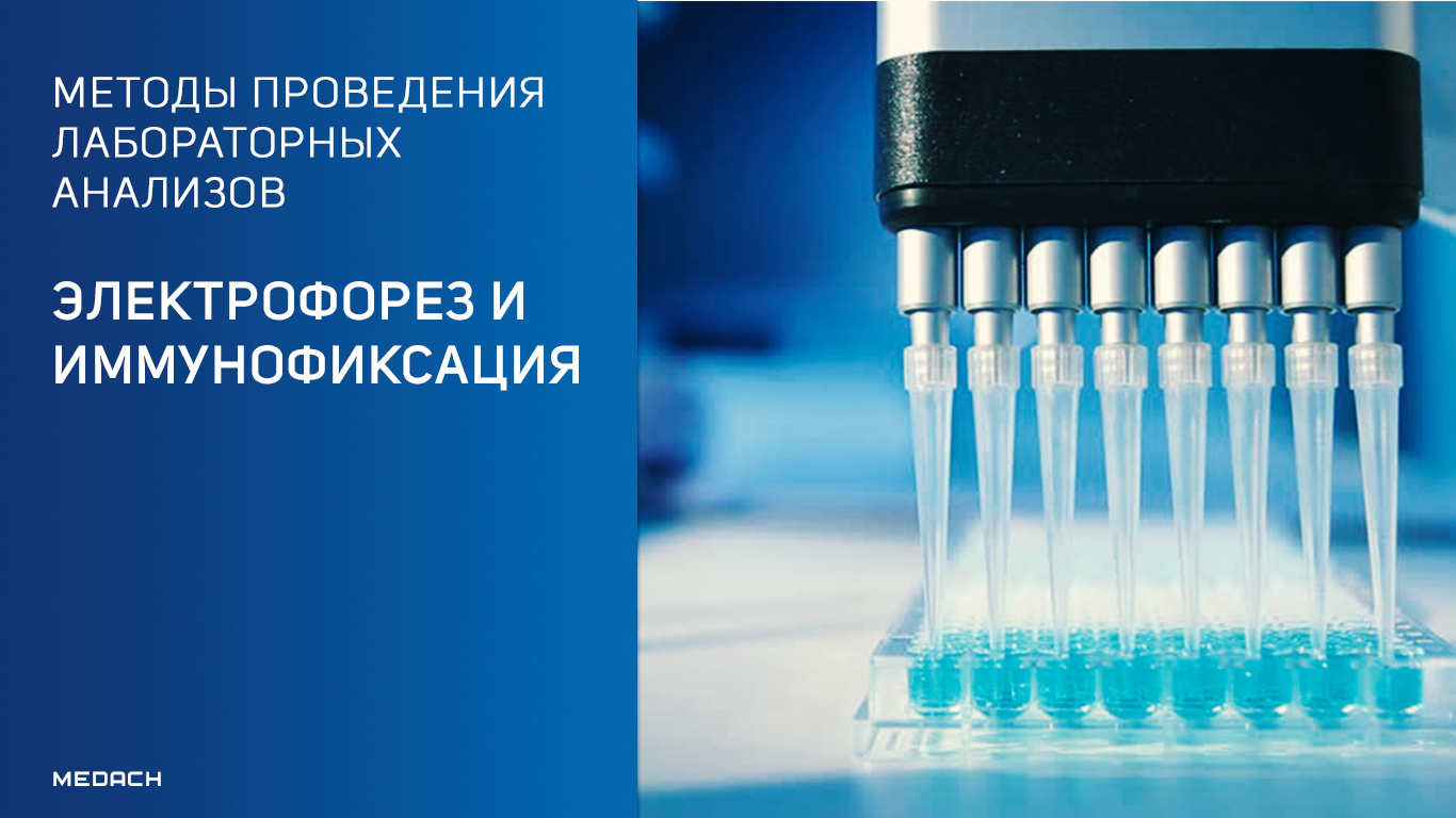 Методы проведения лабораторных анализов: электрофорез и иммунофиксация
