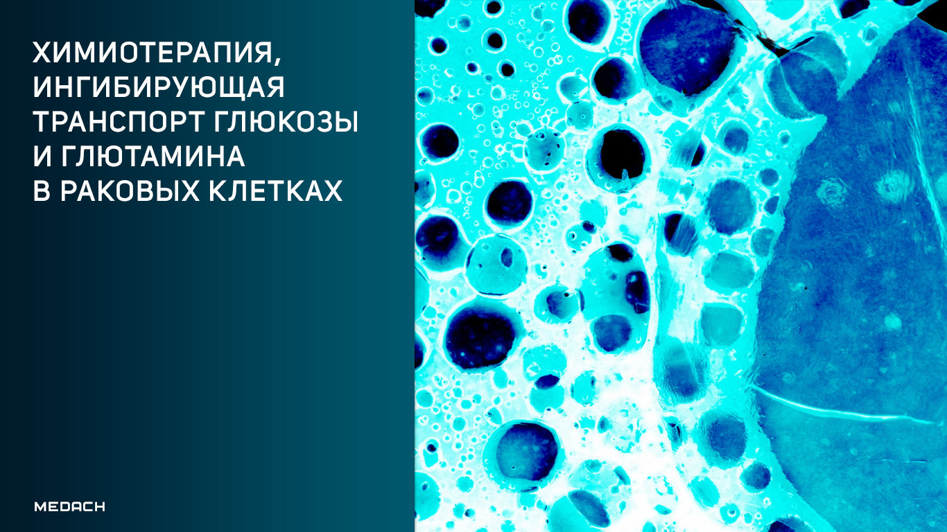 Химиотерапия, ингибирующая транспорт глюкозы и глютамина в раковых клетках