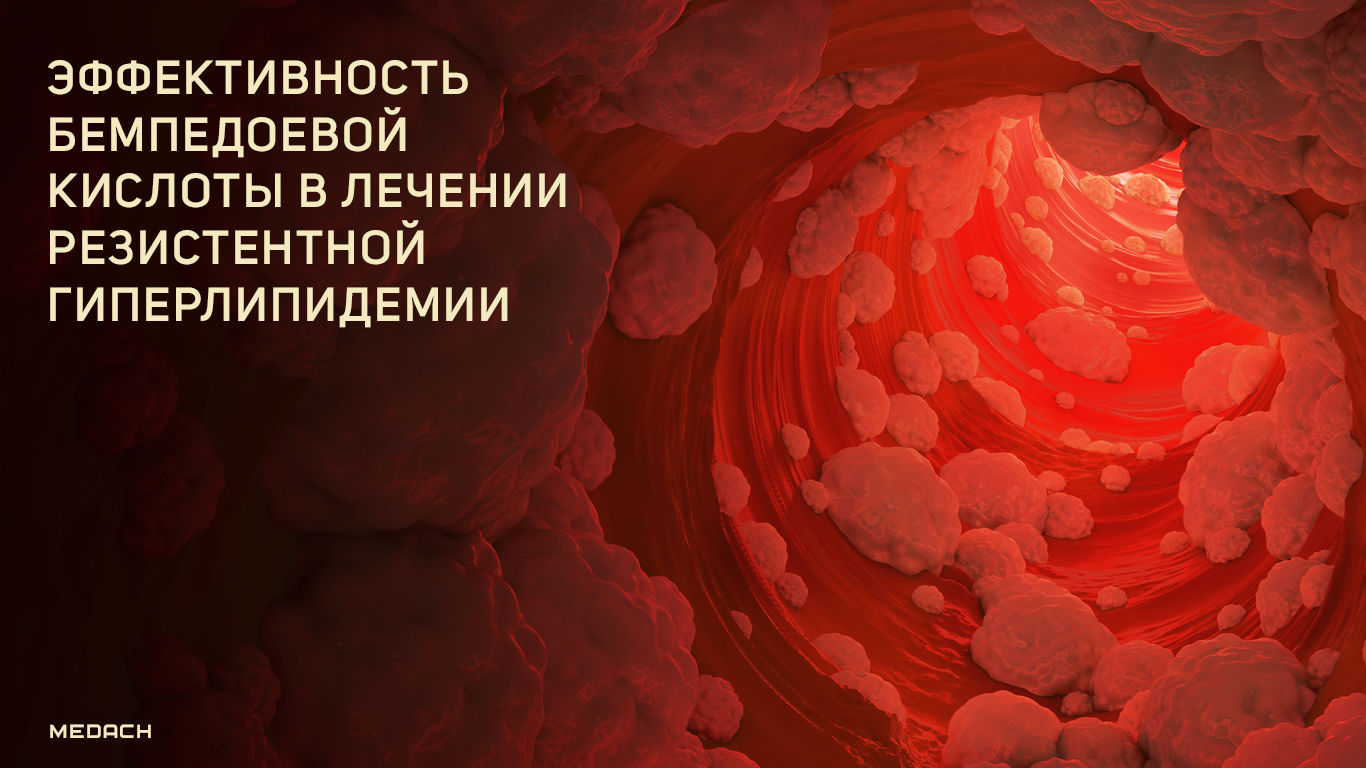 Эффективность бемпедоевой кислоты в лечении резистентной гиперлипидемии
