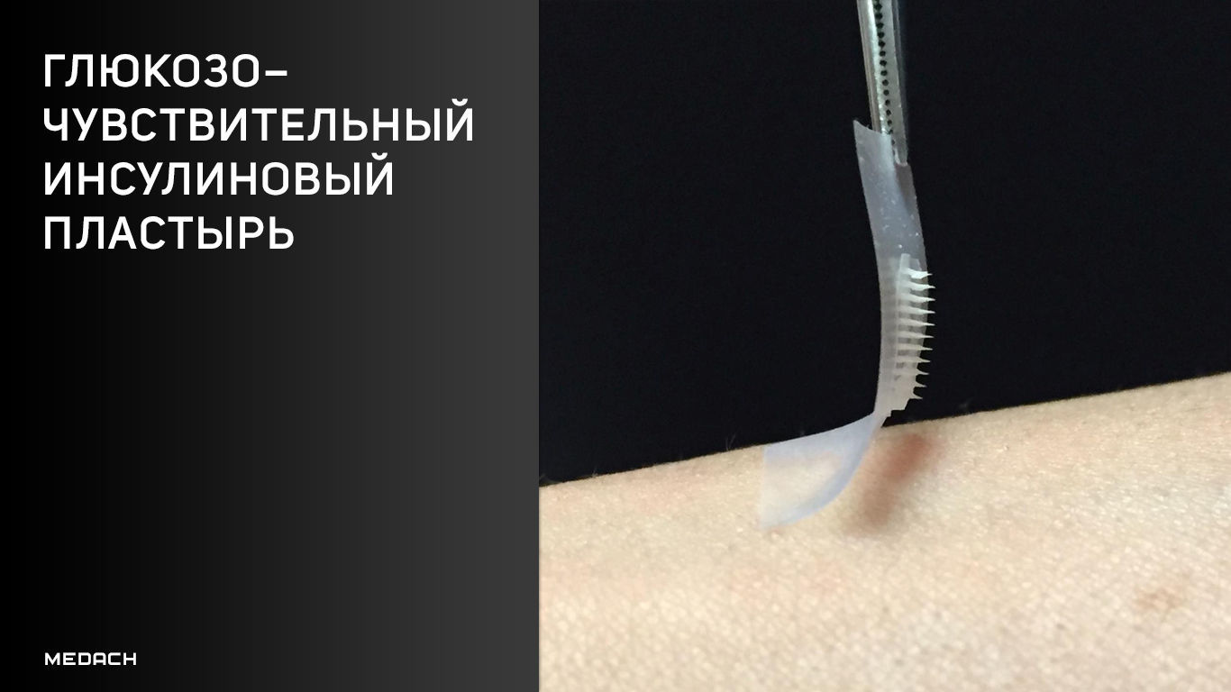 Глюкозочувствительный инсулиновый пластырь