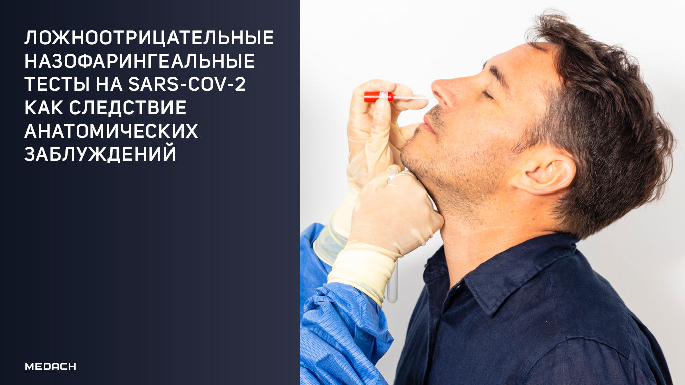 Ложноотрицательные назофарингеальные тесты на SARS-CoV-2 как следствие анатомических заблуждений