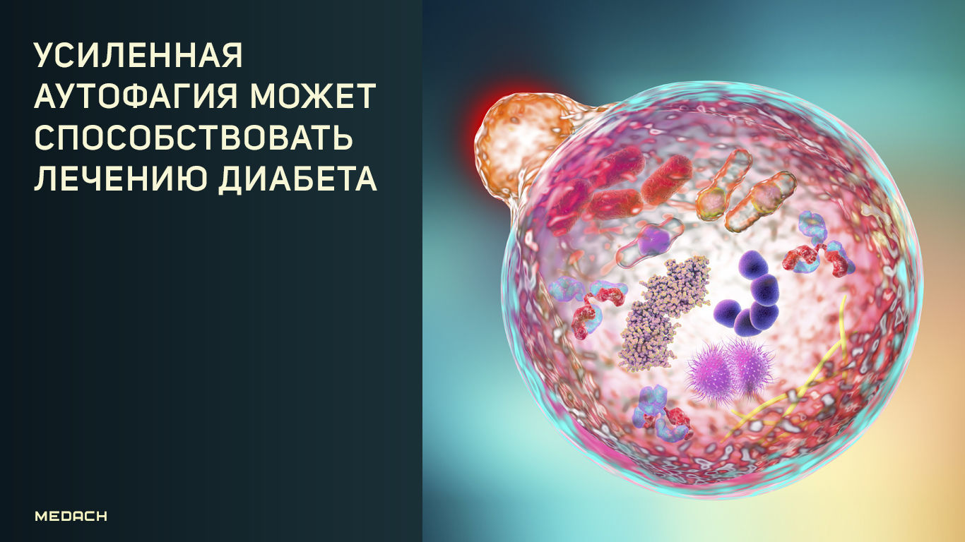 Усиленная аутофагия может способствовать лечению диабета