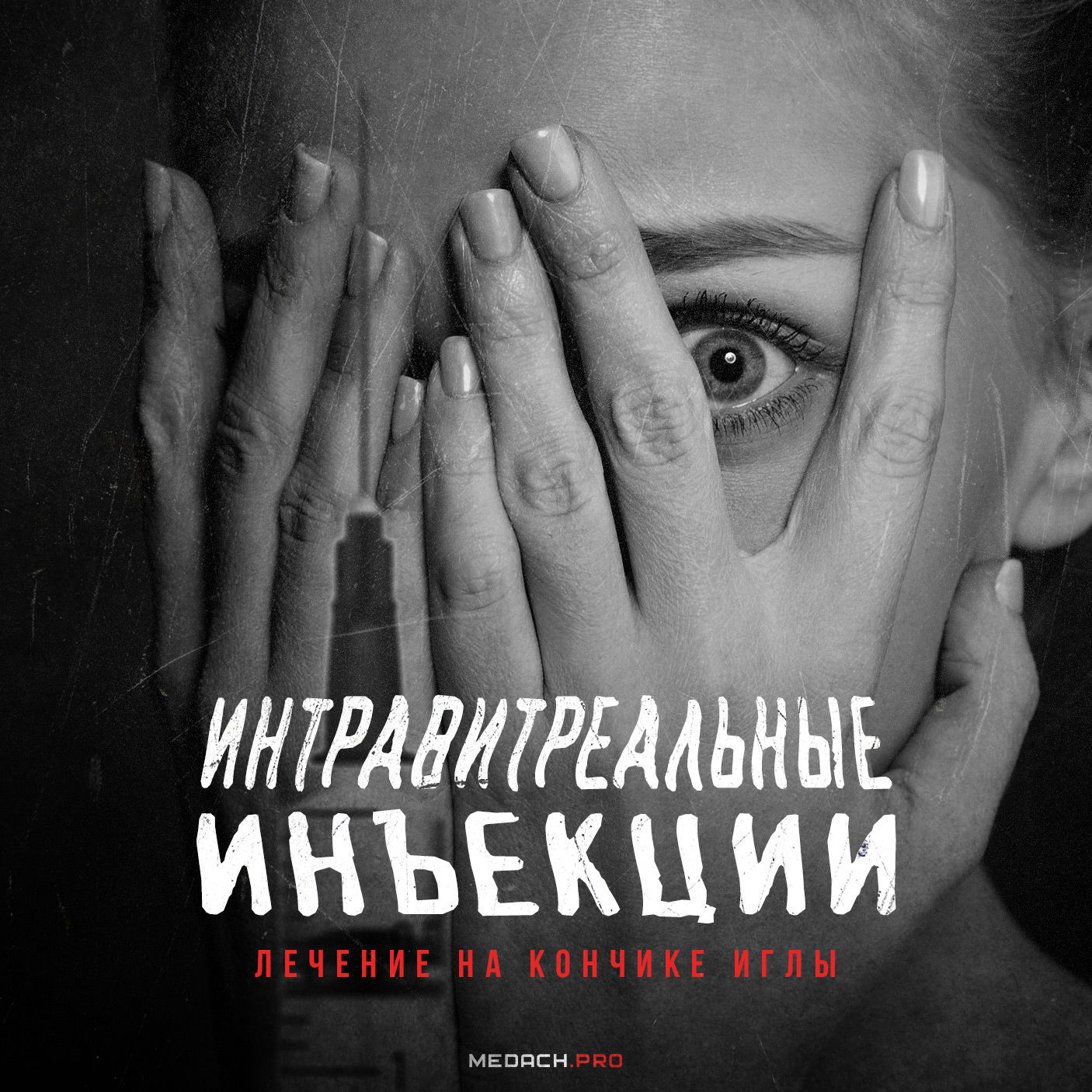 Интравитреальные инъекции: лечение на кончике иглы
