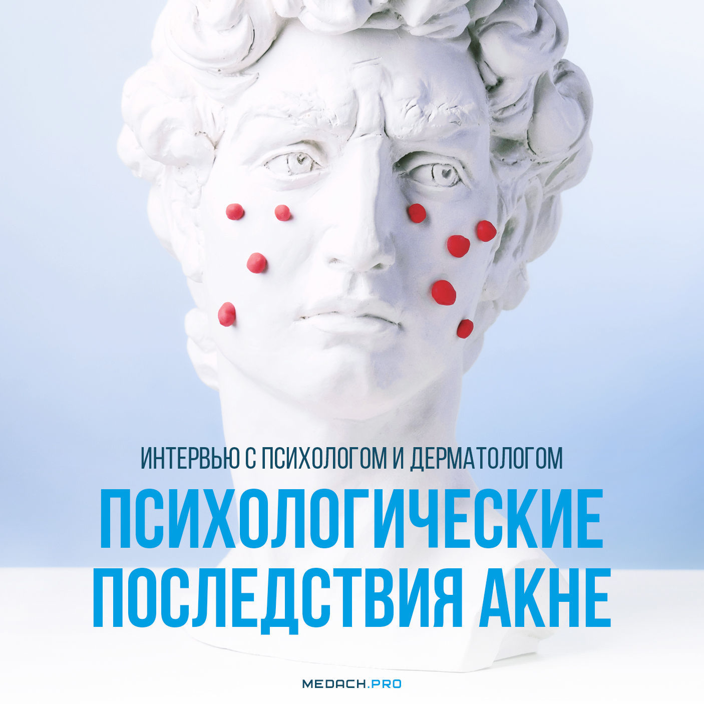 Психологические последствия акне: интервью с психологом и дерматологом