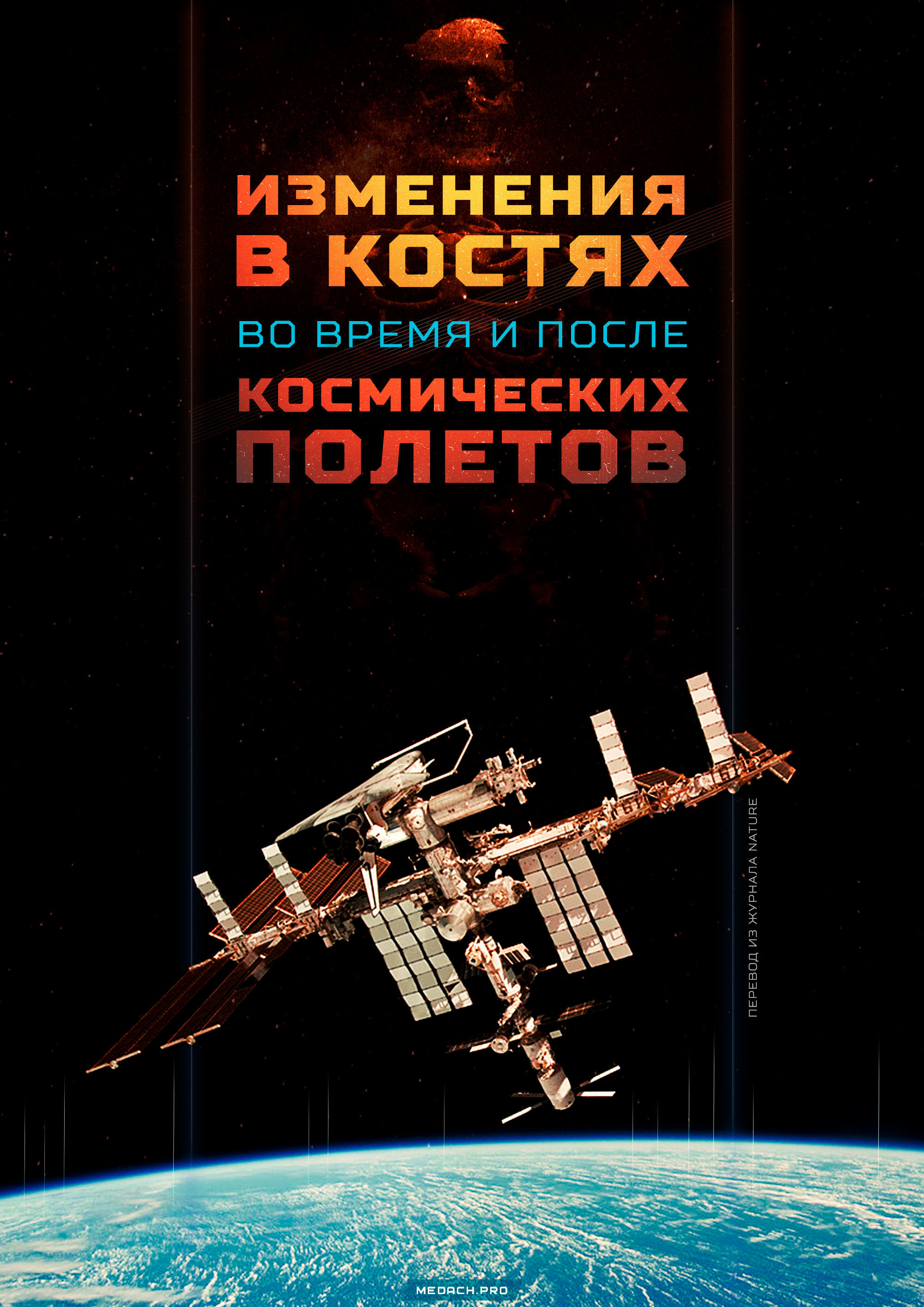 Изменения в костях во время и после космических полетов