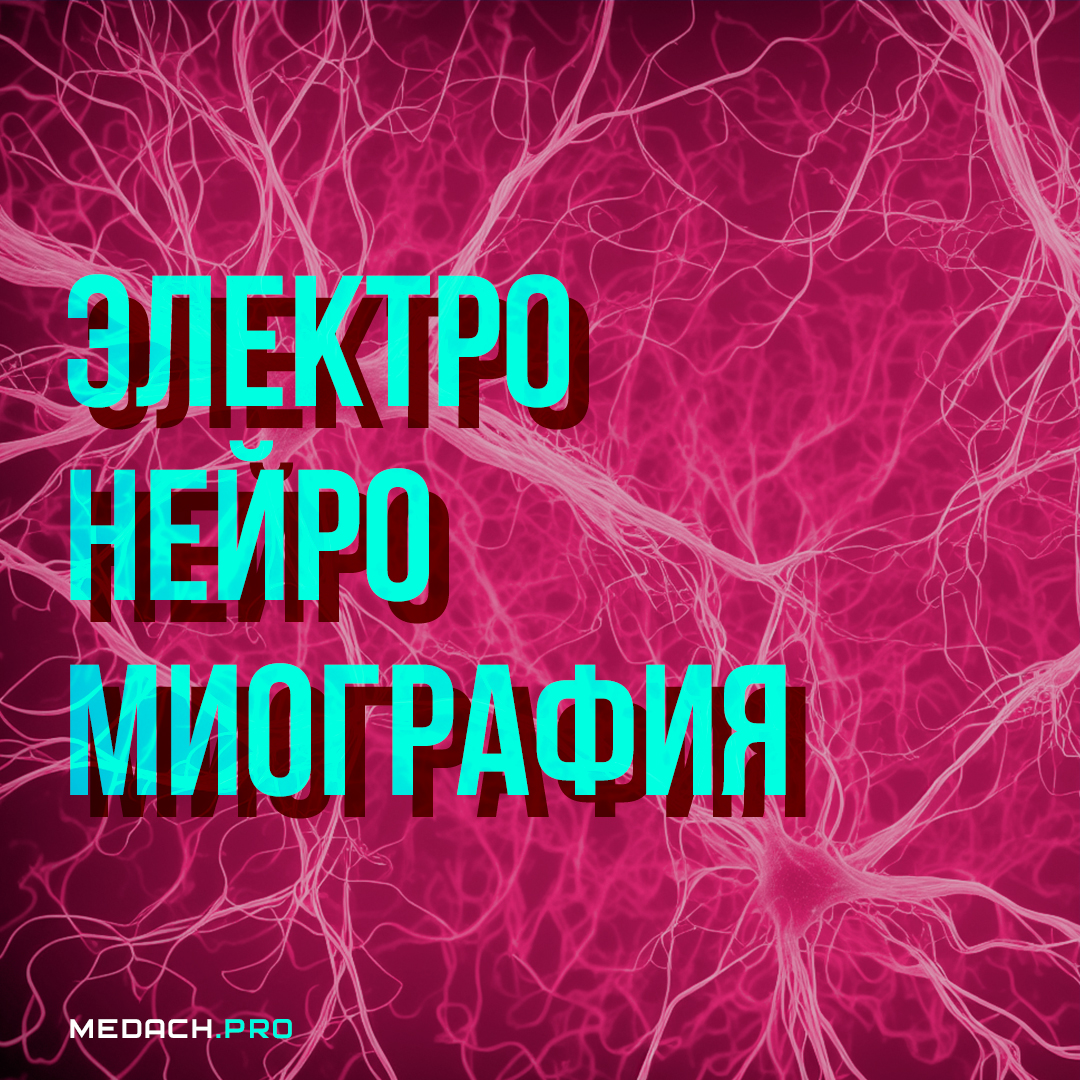 Электронейромиография