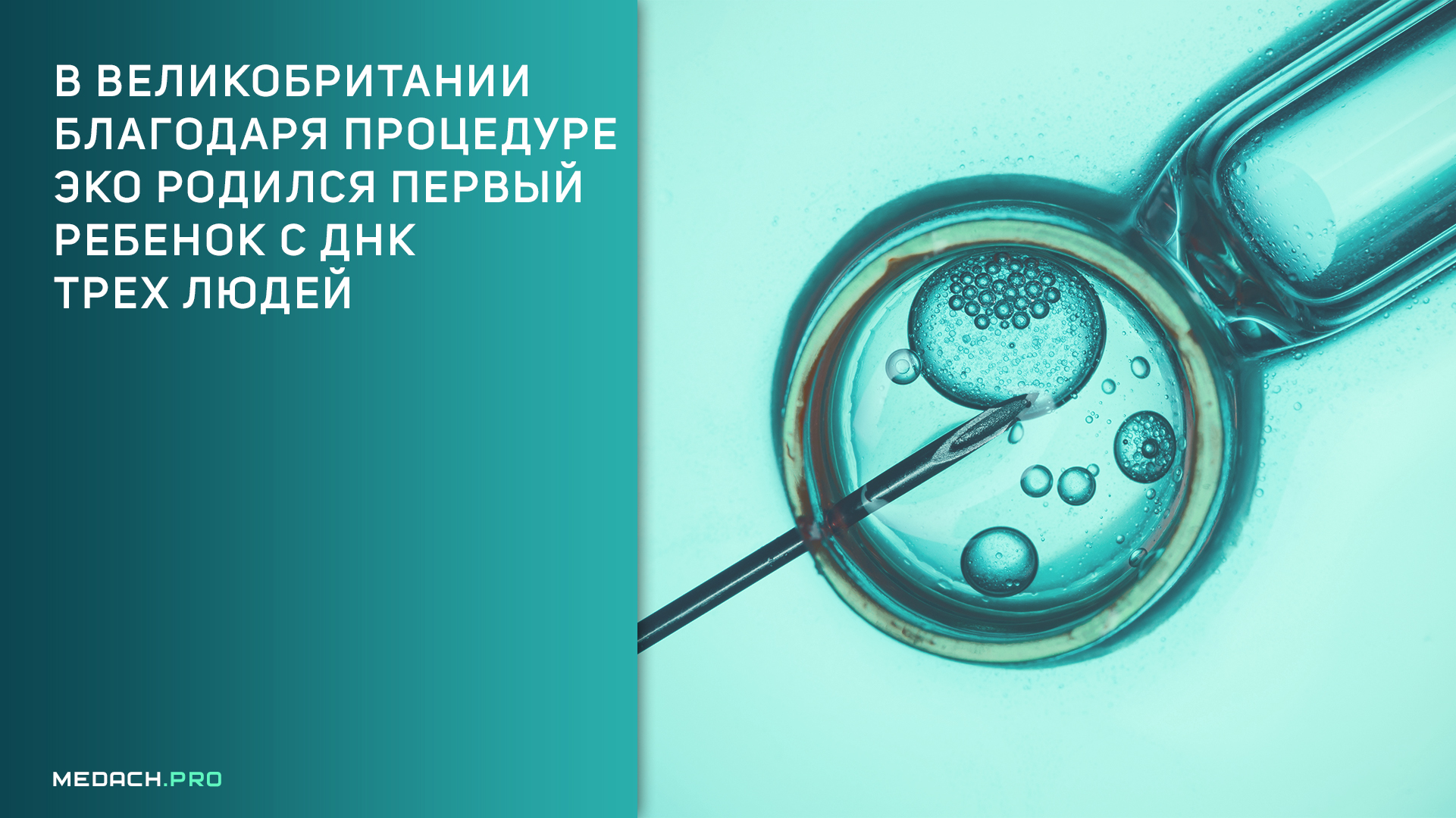 В Великобритании родился первый ребенок с ДНК трех людей благодаря процедуре ЭКО