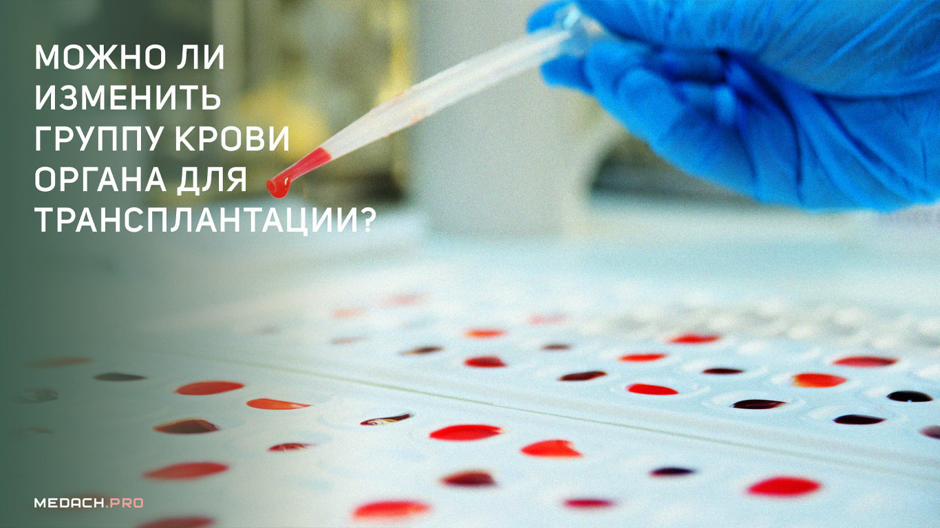 Можно ли изменить группу крови у органа для трансплантации?