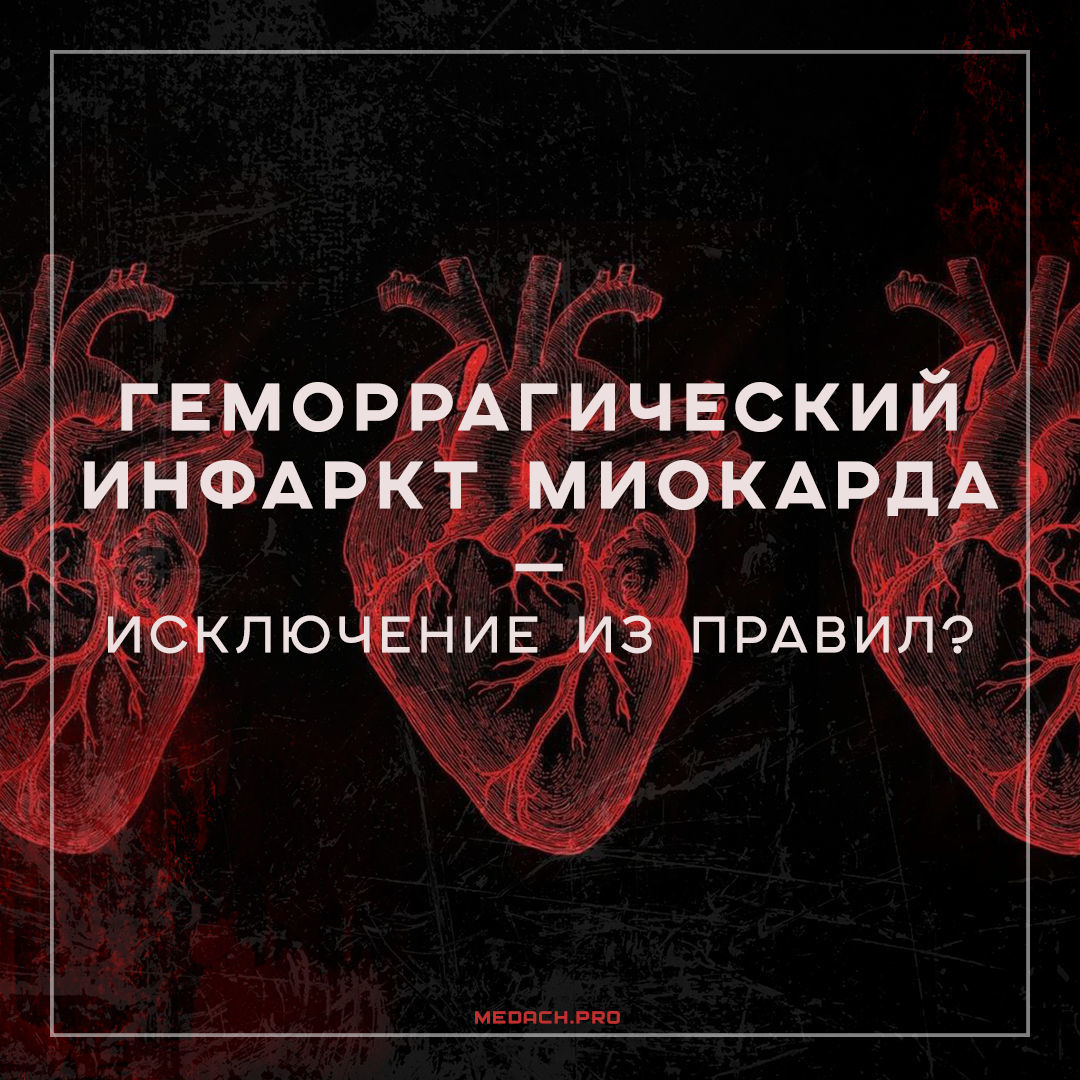 Геморрагический инфаркт миокарда — исключение из правил?