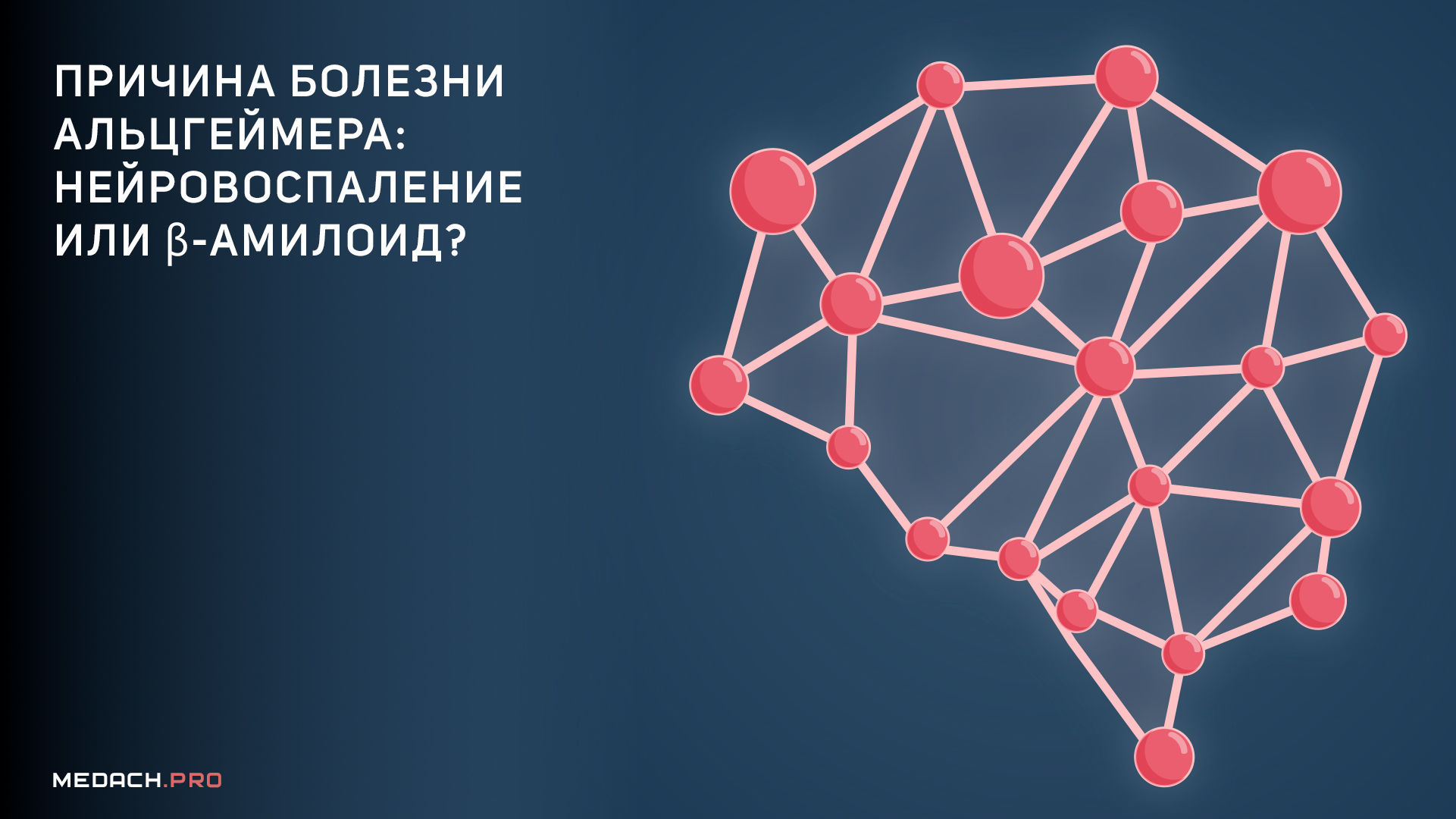В чем причина нарушения работы нейронных сетей в мозге при болезни Альцгеймера: нейровоспаление или накопление β-амилоида?