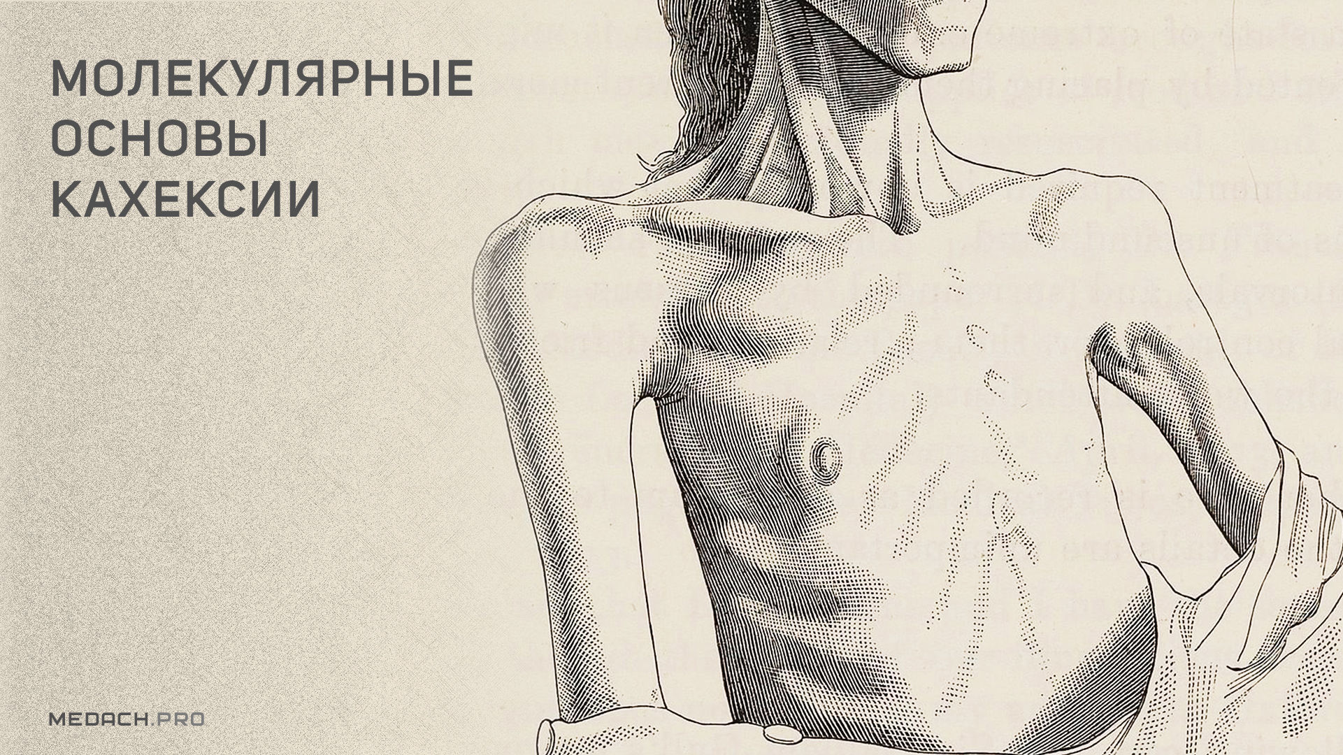 Молекулярные основы кахексии