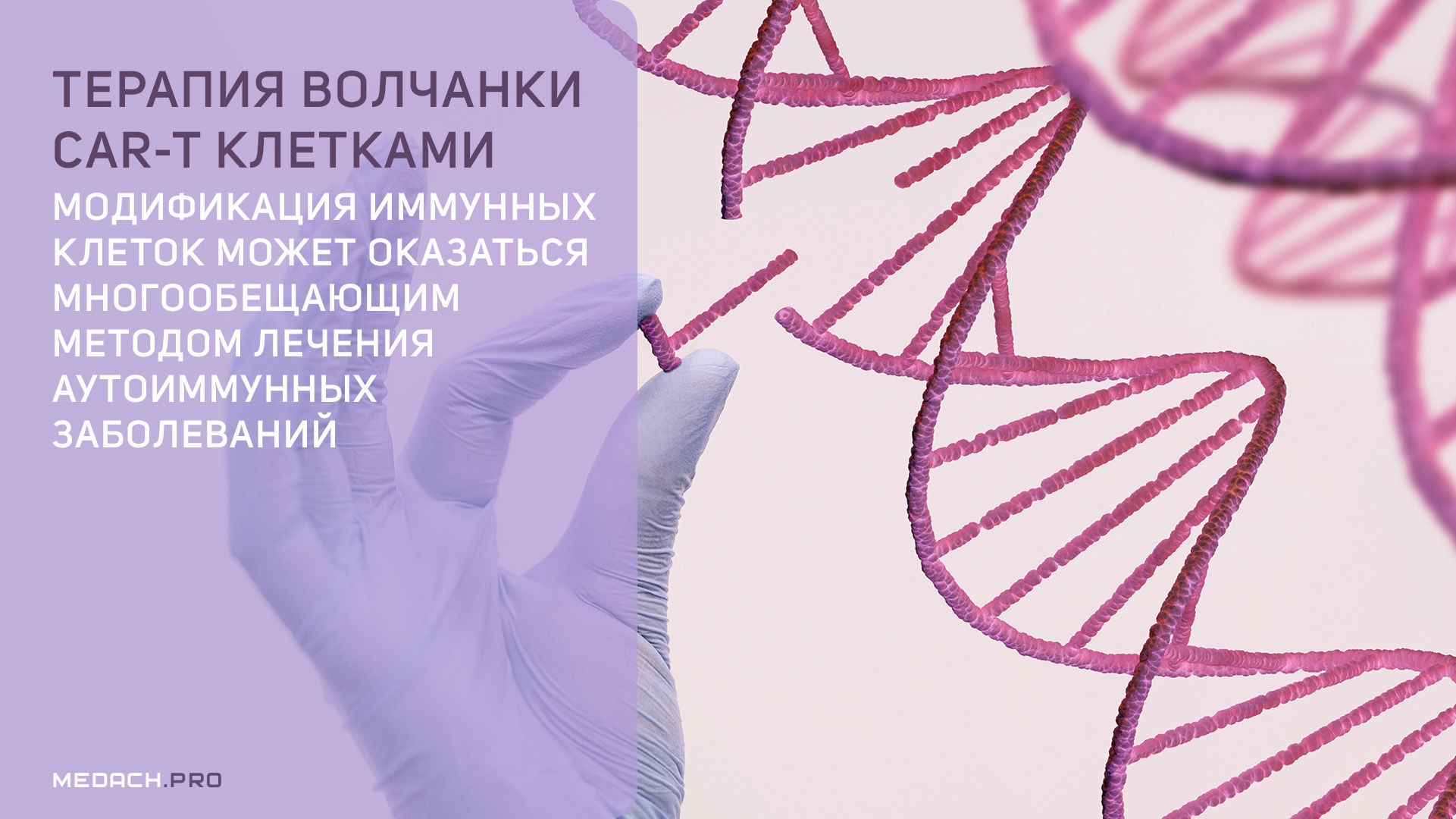 Терапия волчанки CAR-T клетками