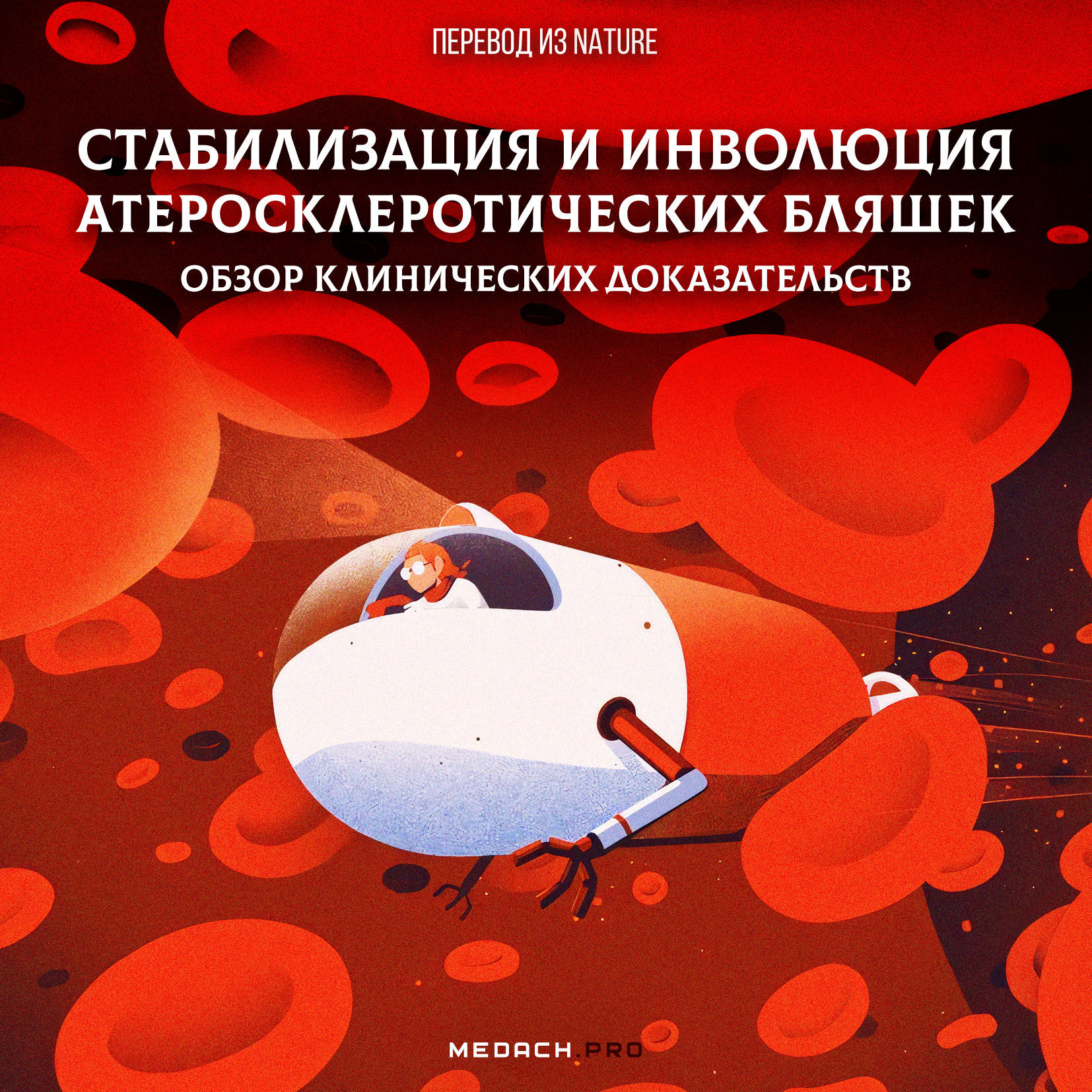 Стабилизация и инволюция атеросклеротических бляшек: обзор клинических доказательств