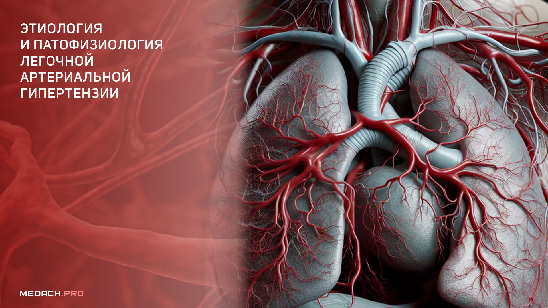 Этиология и патофизиология легочной артериальной гипертензии