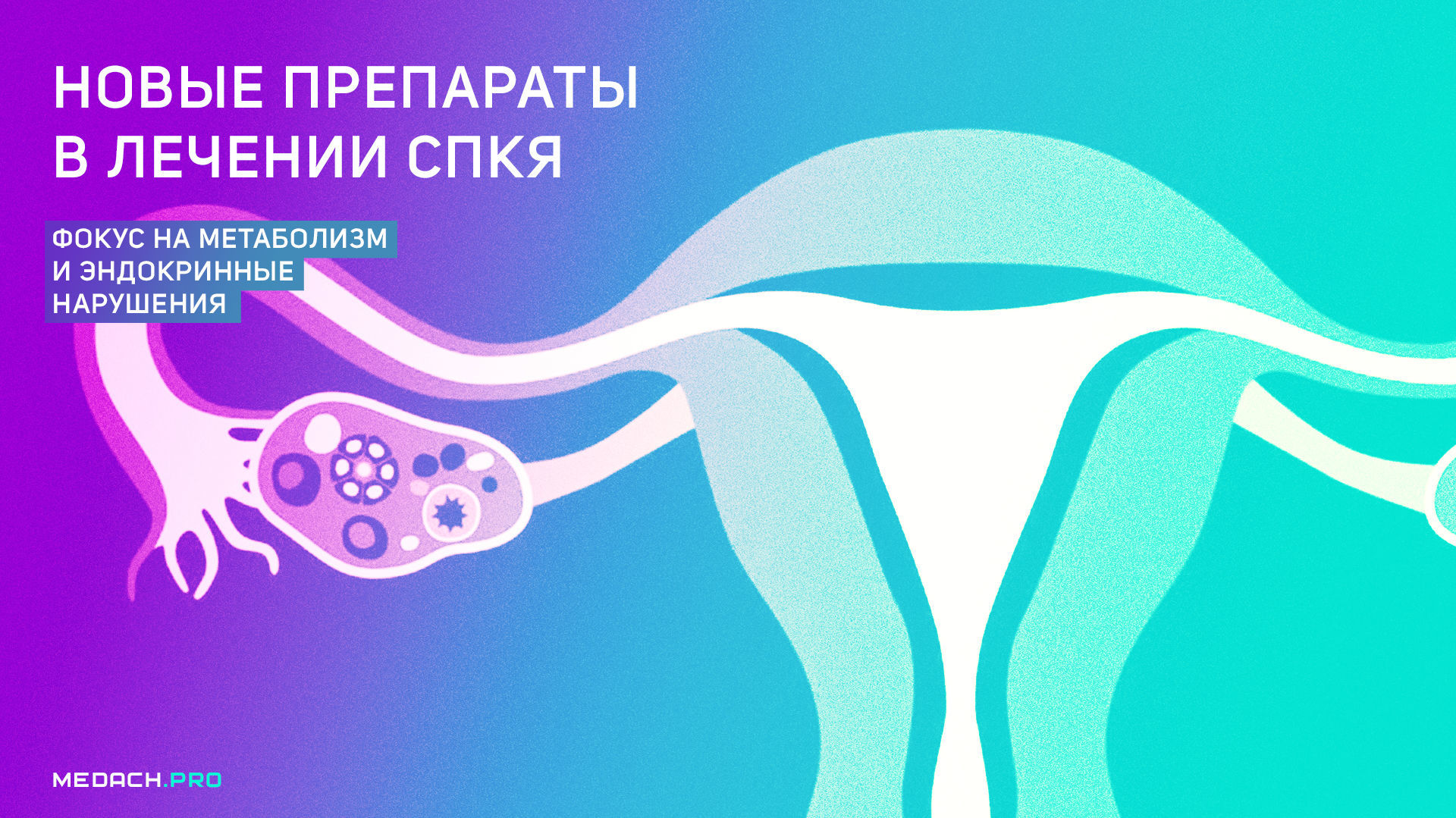 Новые препараты в лечении СПКЯ: фокус на метаболизм и эндокринные нарушения