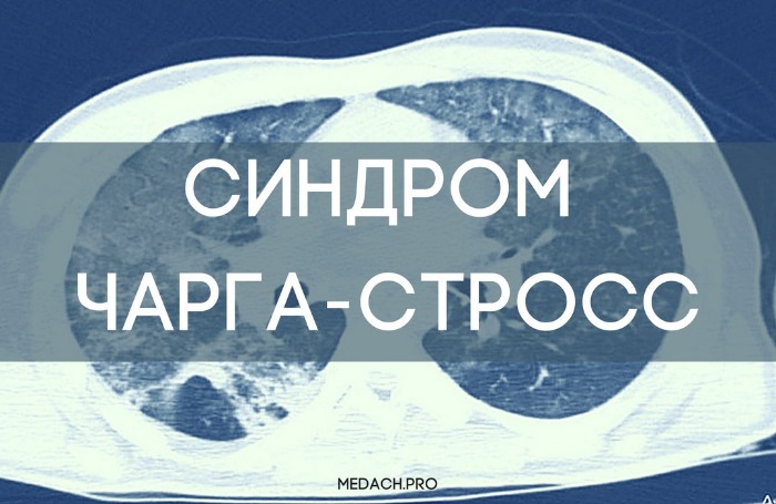 Синдром Чарга-Стросс